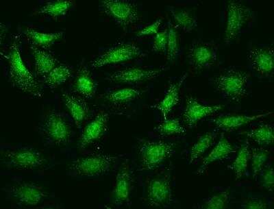 Immunocytochemistry/Immunofluorescence: CaMKV Antibody [NBP3-06485] - Staining of CAMKV in Hela cells. Cells were fixed with 4% PFA, permeabilzed with 0.1% Triton X-100 in PBS,blocked with 10% serum, and incubated with rabbit anti-Human CAMKV polyclonal antibody (dilution ratio 1:1000) at 4? overnight. Then cells were stained with the Alexa Fluor®488-conjugated Goat Anti-rabbit IgG secondary antibody (green). Positive staining was localized to Nucleus and Cytoplasm.