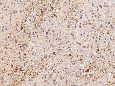 Immunohistochemistry-Paraffin: CaMKV Antibody [NBP2-99963] - CAMKV in human brain with rabbit polyclonal antibody (1:1000).