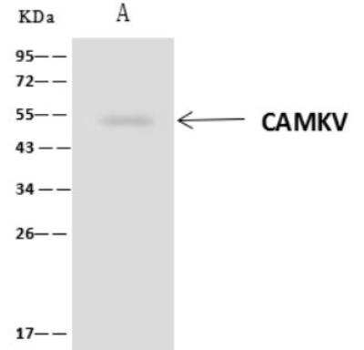 Immunoprecipitation: CaMKV Antibody [NBP3-06485] - Lane A:0.5 mg HepG2 Whole Cell Lysate1 uL anti-CAMKV rabbit polyclonal antibody and 60 ug of Immunomagnetic beads Protein A/G.Primary antibody:Anti-CAMKV rabbit polyclonal antibody,at 1:500 dilution Secondary antibody:Clean-Blot IP Detection Reagent (HRP) at 1:1000dilutionDeveloped using the ECL technique.Performed under reducing conditions.Predicted band size: 54 kDaObserved band size :54 kDa
