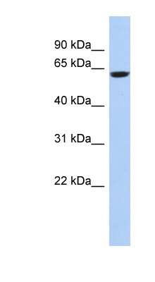 Western Blot: CaMKV Antibody [NBP1-56677] - 721_B cell lysate, concentration 0.2-1 ug/ml.