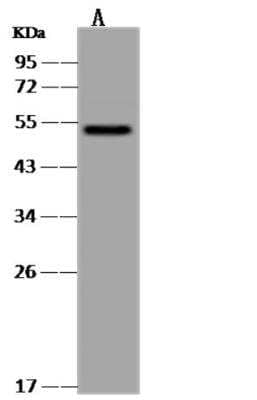 Western Blot CaMKV Antibody - BSA Free