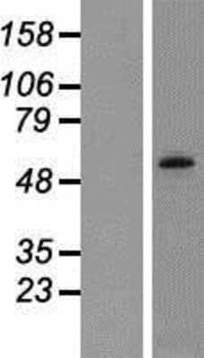 Western Blot: CaMKV Overexpression Lysate (Adult Normal) [NBP2-06366] Left-Empty vector transfected control cell lysate (HEK293 cell lysate); Right -Over-expression Lysate for CaMKV.