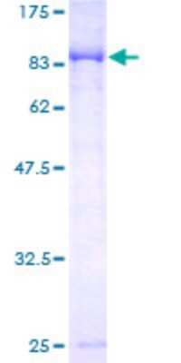 SDS-Page: CaMKV Recombinant Protein [H00079012-P01]