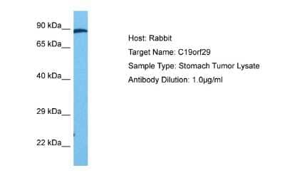 Western Blot: Cactin Antibody [NBP2-87112] - Host: Rabbit. Target Name: C19ORF29. Sample Tissue: Human Stomach Tumor lysates. Antibody Dilution: 1ug/ml