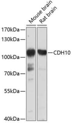 Western Blot Cadherin-10 Antibody - BSA Free