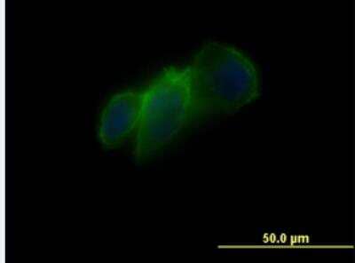 Immunocytochemistry/Immunofluorescence: Cadherin-11 Antibody (1H1) [H00001009-M02-100ug] - Monoclonal antibody to CDH11 on PC3-MM2 cell. [antibody concentration 10 ug/ml