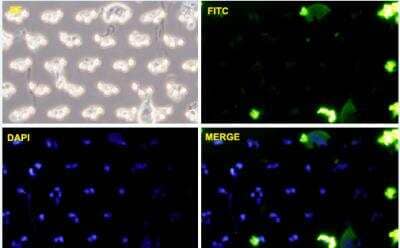 Immunocytochemistry/Immunofluorescence: Cadherin-11 Antibody (1H1) [H00001009-M02-100ug] - PC3-MM2 cells were stained with CDH11-FITC labeled monoclonal antibody (Green). The cell nucleus were counterstained with DAPI (Blue).