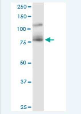Western Blot: Cadherin-11 Antibody (1H1) [H00001009-M02-100ug] - Analysis of CDH11 expression in human kidney.