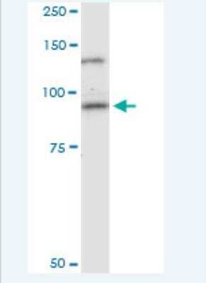 Western Blot: Cadherin-11 Antibody (1H1) [H00001009-M02-100ug] - Analysis of CDH11 expression in human ovarian cancer.