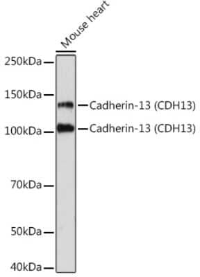 Western Blot: Cadherin-13 Antibody (4Z8D1) [NBP3-16158] - Western blot analysis of extracts of Mouse heart, using Cadherin-13 Rabbit mAb (NBP3-16158) at 1:1000 dilution. Secondary antibody: HRP Goat Anti-Rabbit IgG (H+L) at 1:10000 dilution. Lysates/proteins: 25ug per lane. Blocking buffer: 3% nonfat dry milk in TBST. Detection: ECL Basic Kit. Exposure time: 3min.