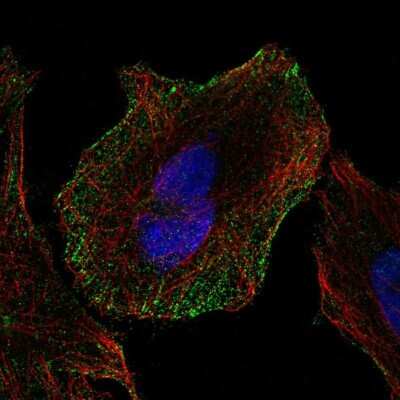 Immunocytochemistry/Immunofluorescence: Cadherin-13 Antibody [NBP1-85708] - Immunofluorescent staining of human cell line SiHa shows localization to plasma membrane. Antibody staining is shown in green.