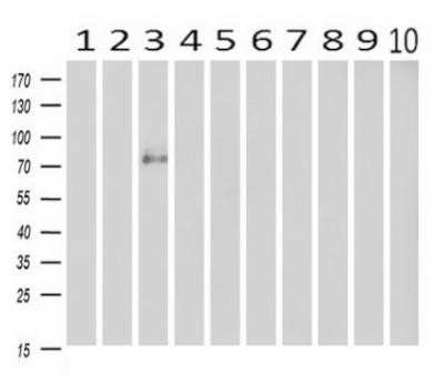 Western Blot: Cadherin-13 Antibody (OTI3H6) - Azide and BSA Free [NBP2-70385] - Analysis of extracts (10ug) from 10 Human tissue by using anti-CDH13 monoclonal antibody at 1:500 (1: Testis; 2: Omentum; 3: Uterus; 4: Breast; 5: Brain; 6: Liver; 7: Ovary; 8: Thyroid gland; 9: colon;10: spleen).