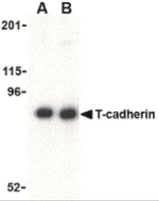 Western Blot: Cadherin-13 Antibody [NBP2-26611] - Western blot analysis of Cadherin-13 in 3T3 lysate with Cadherin-13 antibody at (A) 0.5 and (B) 1 ug/mL.