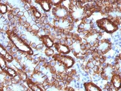 Immunohistochemistry-Paraffin: Cadherin-16 Antibody (CDH16/1071) - Azide and BSA Free [NBP2-47745] - Mouse Kidney stained with Cadherin-16 Antibody (CDH16/1071).