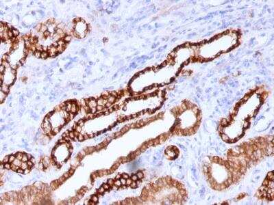 Immunohistochemistry-Paraffin: Cadherin-16 Antibody (CDH16/1071) - IHC-Prediluted [NBP2-48433] - Formalin-fixed, paraffin-embedded human Kidney stained with KSP-Cadherin Mouse Monoclonal Antibody (CDH16/1071).