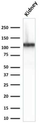 Western Blot: Cadherin-16 Antibody (CDH16/2125) - Azide and BSA Free [NBP2-79856] - Western Blot Analysis of Human Kidney lysate using Cadherin-16 Antibody (CDH16/2125).