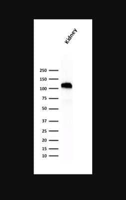 Western Blot: Cadherin-16 Antibody (SPM594) - Azide and BSA Free [NBP2-47746] - Analysis of human Kidney lysateCadherin-16 Antibody (CDH16/1071)Cadherin-16 Antibody (SPM594).