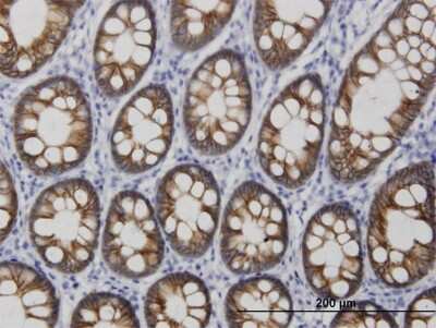 Immunohistochemistry-Paraffin: Cadherin-17 Antibody (3H2) [H00001015-M03] - Analysis of monoclonal antibody to CDH17 on formalin-fixed paraffin-embedded human colon. Antibody concentration 3 ug/ml