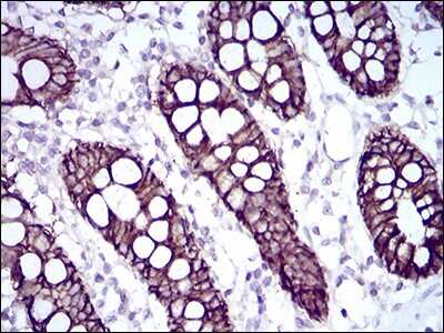 Immunohistochemistry-Paraffin: Cadherin-17 Antibody (7D10E1) [NBP2-52439] - Analysis of colon tissues using CDH17 mouse mAb with DAB staining.