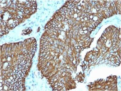 Immunohistochemistry-Paraffin: Cadherin-17 Antibody (CDH17/2618) - BSA Free [NBP2-79857] - Formalin-fixed, paraffin-embedded human Colon stained with Cadherin-17 Antibody (CDH17/2618).