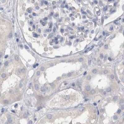 Immunohistochemistry-Paraffin: Cadherin-17 Antibody [NBP1-88237] - Staining of human kidney.