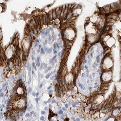 Immunohistochemistry-Paraffin: Cadherin-17 Antibody [NBP1-88237] - Staining of human colon.