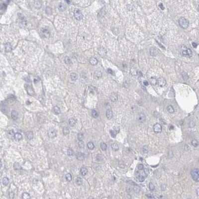 Immunohistochemistry-Paraffin: Cadherin-17 Antibody [NBP1-88237] - Staining of human liver using Anti-CDH17 antibody NBP1-88237.