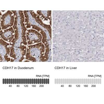 <b>Orthogonal Strategies Validation. </b>Immunohistochemistry-Paraffin: Cadherin-17 Antibody [NBP1-88237] - Analysis in human duodenum and liver tissues using NBP1-88237 antibody. Corresponding Cadherin-17 RNA-seq data are presented for the same tissues.