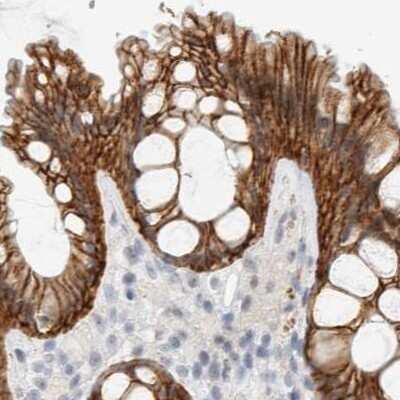 Immunohistochemistry-Paraffin: Cadherin-17 Antibody [NBP1-88239] - Staining of human colon.