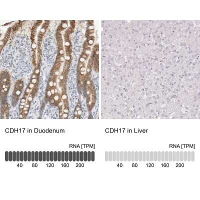 Immunohistochemistry-Paraffin: Cadherin-17 Antibody [NBP1-88239] - Analysis in human duodenum and liver tissues using NBP1-88239 antibody. Corresponding Cadherin-17 RNA-seq data are presented for the same tissues.