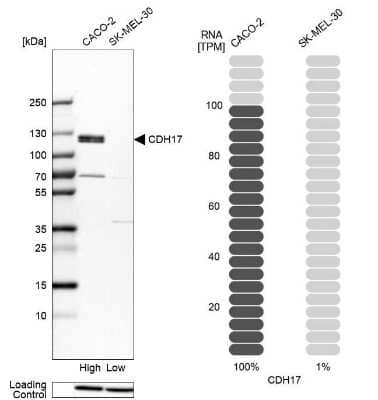 Western Blot: Cadherin-17 Antibody [NBP1-88237] - Analysis in human cell lines Caco-2 and SK-MEL-30 using anti-CDH17 antibody. Corresponding CDH17 RNA-seq data are presented for the same cell lines. Loading control: anti-HDAC1.