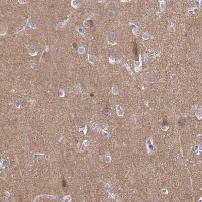 Immunohistochemistry-Paraffin: Cadherin-18 Antibody [NBP2-48527] - Staining of human cerebral cortex shows moderate positivity in neuropil.