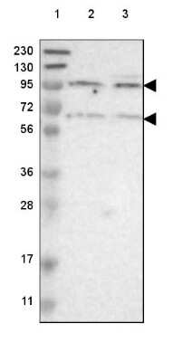 Western Blot: Cadherin-18 Antibody [NBP2-48527] - Lane 1: Marker [kDa] 230, 130, 95, 72, 56, 36, 28, 17, 11Lane 2: Human cell line RT-4Lane 3: Human cell line U-251 MG