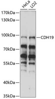 Western Blot Cadherin-19 Antibody - Azide and BSA Free