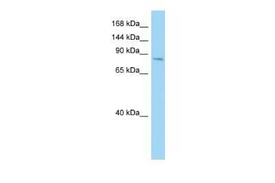 Western Blot: Cadherin-26 Antibody [NBP2-84582] - Host: Rabbit. Target Name: CDH26. Sample Type: COLO205 Whole Cell lysates. Antibody Dilution: 1.0ug/ml