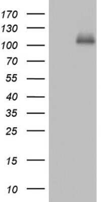 Western Blot: Cadherin-4/R-Cadherin Antibody (4F5) [NBP2-46208] - Analysis of HEK293T cells were transfected with the pCMV6-ENTRY control (Left lane) or pCMV6-ENTRY Cadherin-4/R-Cadherin.