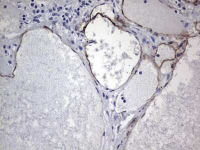 Immunohistochemistry: Cadherin-4/R-Cadherin Antibody (OTI4F5) - Azide and BSA Free [NBP2-70384] - Analysis of Human thyroid tissue. (Heat-induced epitope retrieval by 1 mM EDTA in 10mM Tris, pH8.5, 120C for 3min)