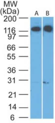 Western Blot Cadherin-4/R-Cadherin Antibody