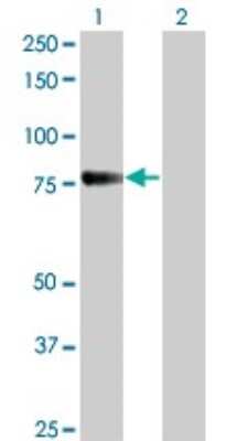 Western Blot: Cadherin-6/KCAD Antibody (2F2) [H00001004-M05] - Analysis of CDH6 expression in transfected 293T cell line by CDH6 monoclonal antibody (M05), clone 2F2. Lane 1: CDH6 transfected lysatE (73.9 KDa). Lane 2: Non-transfected lysate.