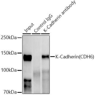 Immunoprecipitation: Cadherin-6/KCAD Antibody (5N2K3) [NBP3-16464] - Immunoprecipitation analysis of 300ug extracts of HepG2 cells using 3ug Cadherin-6/KCAD antibody (NBP3-16464). Western blot was performed from the immunoprecipitate using Cadherin-6/KCAD antibody (NBP3-16464) at a dilition of 1:1000.