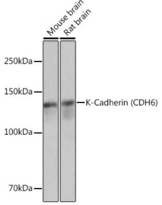 Western Blot: Cadherin-6/KCAD Antibody (5N2K3) [NBP3-16464] - Western blot analysis of extracts of various cell lines, using Cadherin-6/KCAD Rabbit mAb (NBP3-16464) at 1:3000 dilution. Secondary antibody: HRP Goat Anti-Rabbit IgG (H+L) at 1:10000 dilution. Lysates/proteins: 25ug per lane. Blocking buffer: 3% nonfat dry milk in TBST. Detection: ECL Basic Kit. Exposure time: 1s.