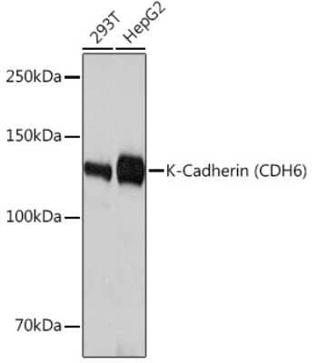 Western Blot: Cadherin-6/KCAD Antibody (5N2K3) [NBP3-16464] - Western blot analysis of extracts of various cell lines, using Cadherin-6/KCAD Rabbit mAb (NBP3-16464) at 1:3000 dilution. Secondary antibody: HRP Goat Anti-Rabbit IgG (H+L) at 1:10000 dilution. Lysates/proteins: 25ug per lane. Blocking buffer: 3% nonfat dry milk in TBST. Detection: ECL Basic Kit. Exposure time: 10s.