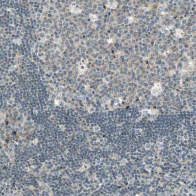 Immunohistochemistry-Paraffin: Cadherin-6/KCAD Antibody [NBP1-87588] - Staining of human lymph node shows low expression as expected.