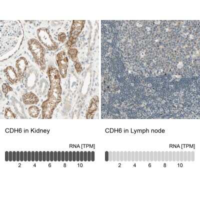 <b>Orthogonal Strategies Validation. </b>Immunohistochemistry-Paraffin: Cadherin-6/KCAD Antibody [NBP1-87588] - Staining in human kidney and lymph node tissues using anti-CDH6 antibody. Corresponding CDH6 RNA-seq data are presented for the same tissues.