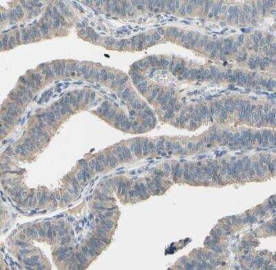 Immunohistochemistry-Paraffin: Cadherin-6/KCAD Antibody [NBP1-90347] - Staining of human fallopian tube shows moderate membranous and cytoplasmic positivity in cells in glandular cells.