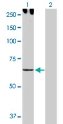 Western Blot: Cadherin-6/KCAD Antibody [H00001004-D01P] - Analysis of CDH6 expression in transfected 293T cell line by CDH6 polyclonal antibody.Lane 1: CDH6 transfected lysate(73.90 KDa).Lane 2: Non-transfected lysate.
