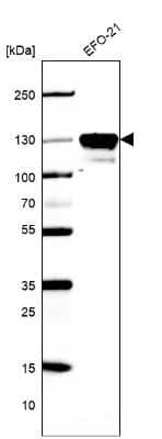 Western Blot Cadherin-6/KCAD Antibody