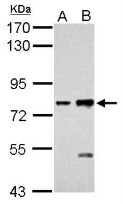 Western Blot: Cadherin-6/KCAD Antibody [NBP2-17011] - Sample (30 ug of whole cell lysate) A: H1299 B: HCT116 7. 5% SDS PAGE gel, diluted at 1:2000.