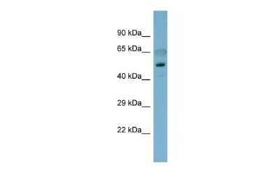 Western Blot: Cadherin-8 Antibody [NBP2-84583] - Host: Rabbit. Target Name: CDH8. Sample Type: Fetal Stomach lysates. Antibody Dilution: 1.0ug/ml