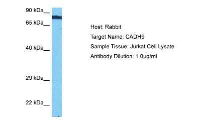 Western Blot Cadherin-9 Antibody - BSA Free